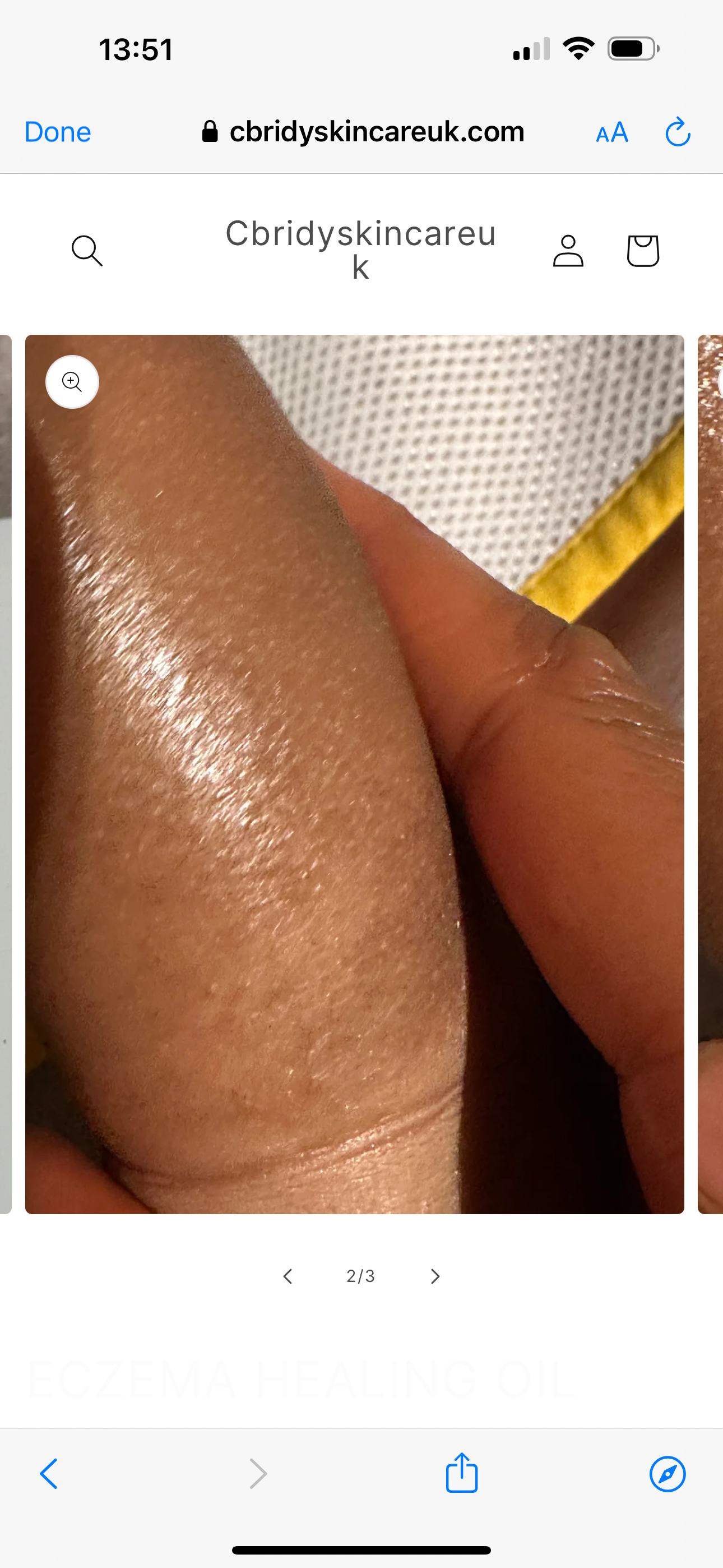 ECZEMA HEALING OIL