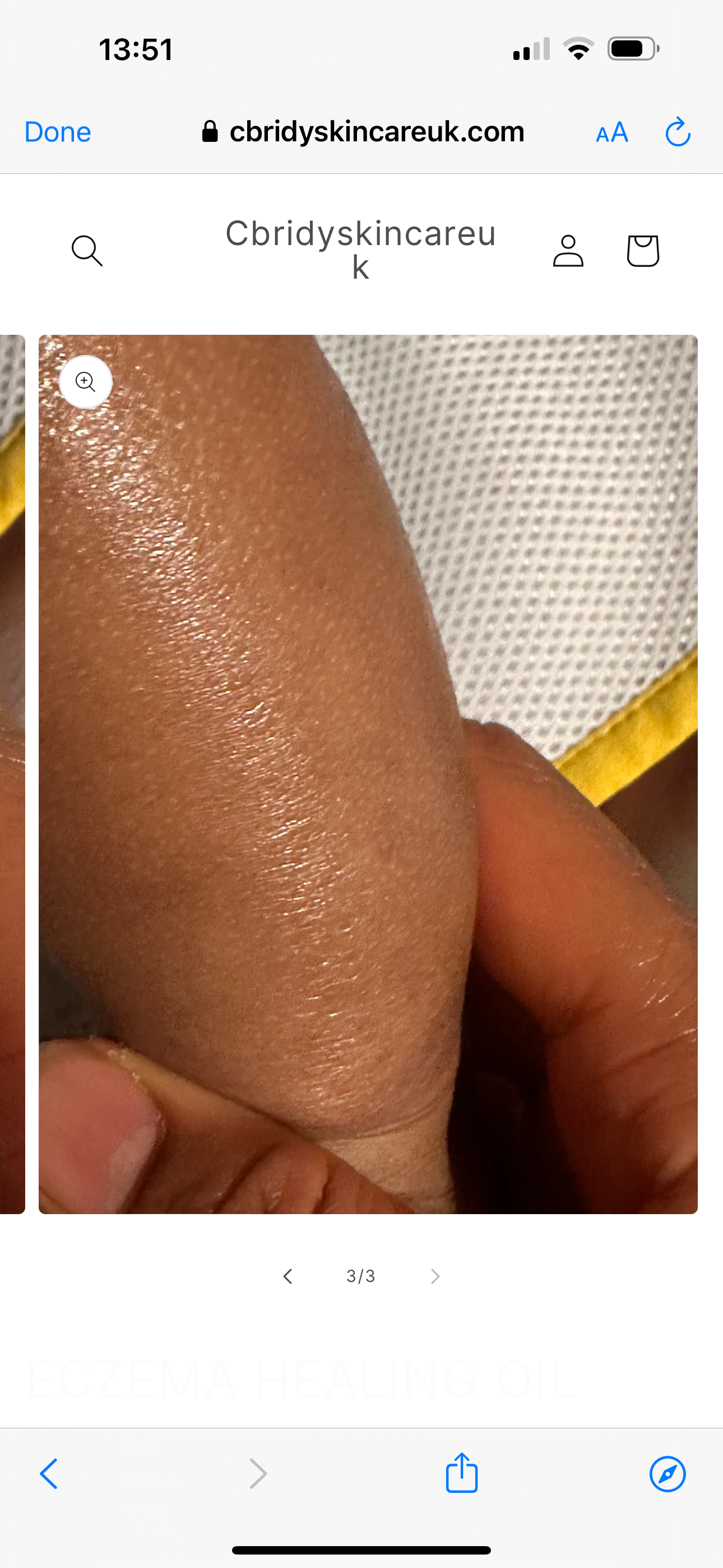 ECZEMA HEALING OIL