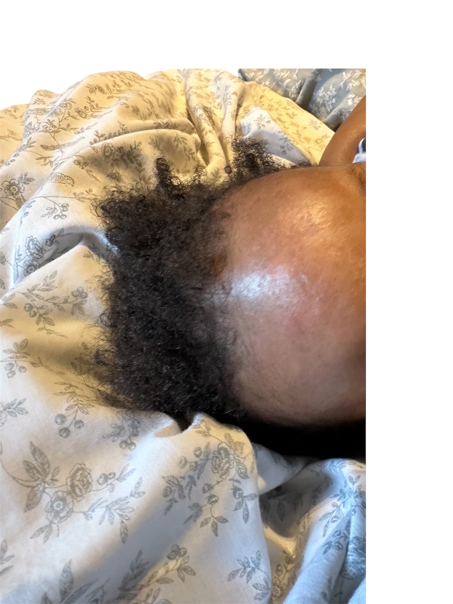 ECZEMA HEALING OIL